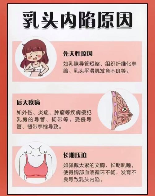 为什么乳头凹陷