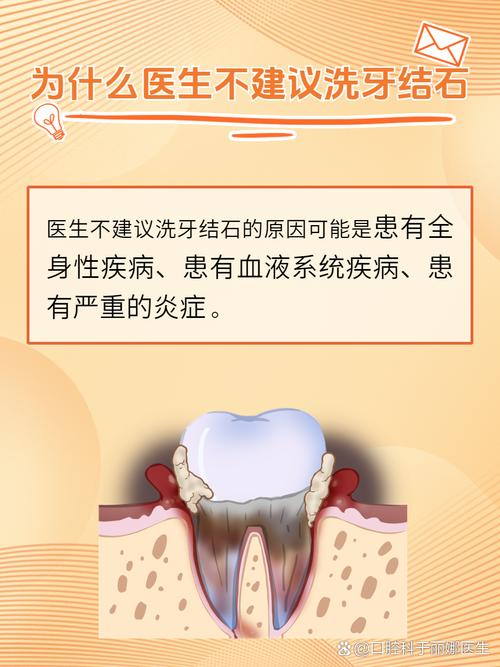 牙结石什么原因