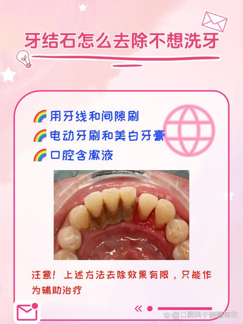 牙结石什么原因