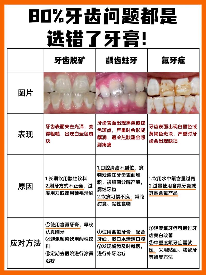 牙结石什么原因