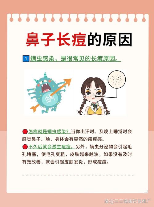 鼻子长痘为什么