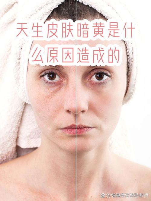 皮肤差什么原因