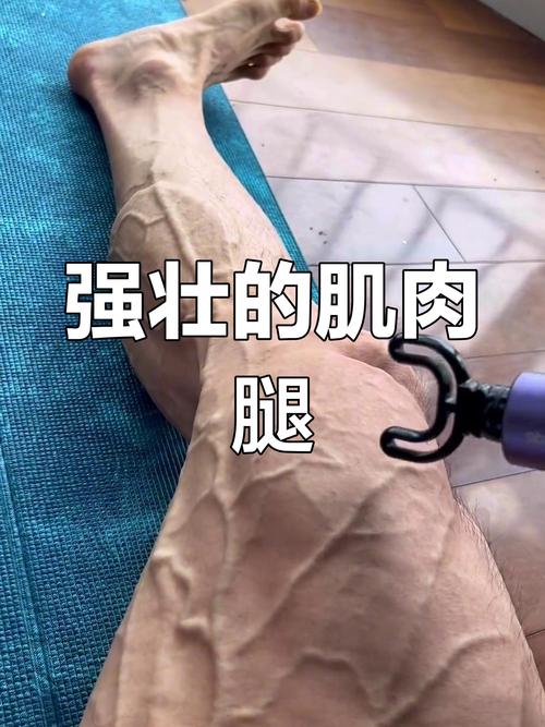什么是肌肉腿