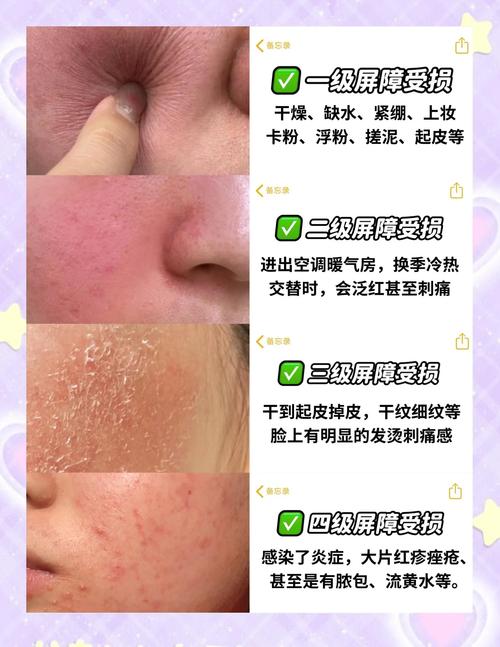 护肤品对皮肤真的好吗