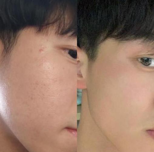 男士洗面奶洗完脸还