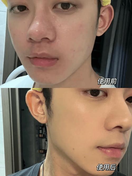 男士洗面奶洗完脸还