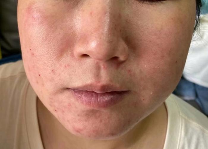 过期洗面奶脸不舒服