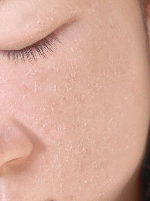 过期洗面奶脸不舒服