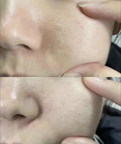 洗面奶把毛孔变大吗