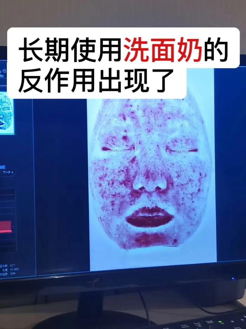 洗面奶把毛孔变大吗