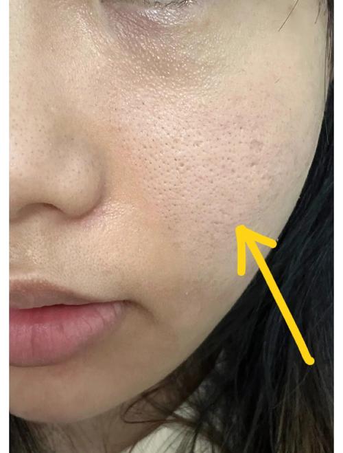 洗面奶把毛孔变大吗