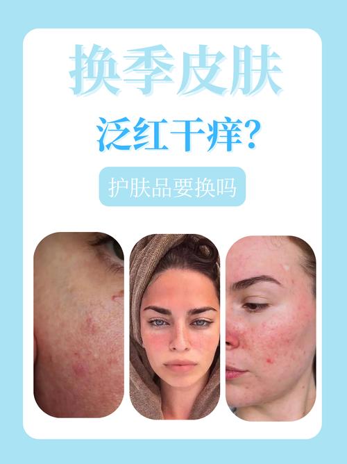 皮肤过敏还擦护肤品吗