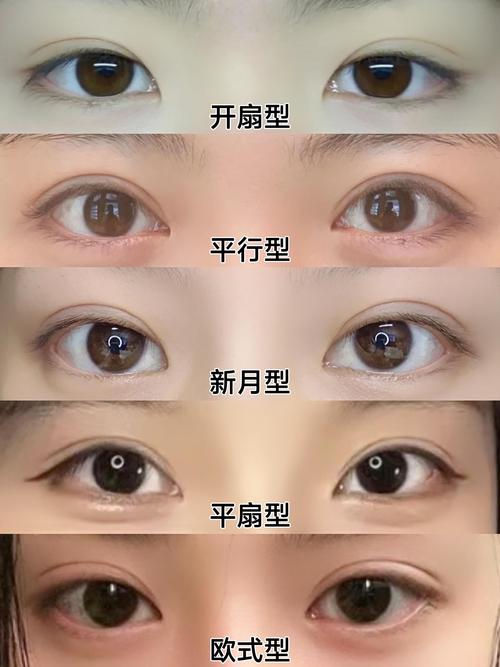 为什么会有双眼皮