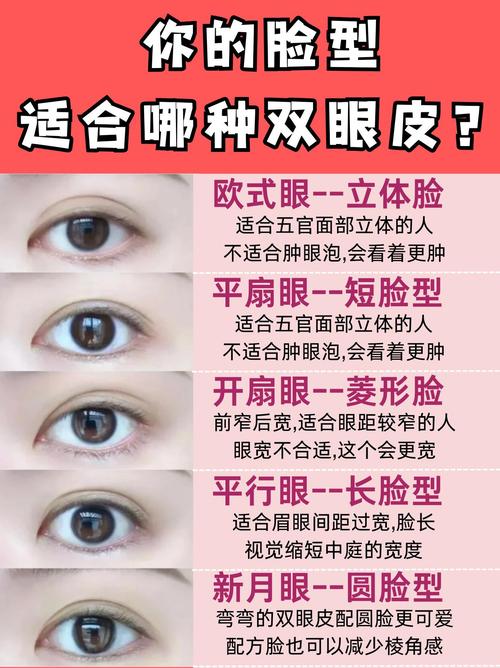 为什么会有双眼皮