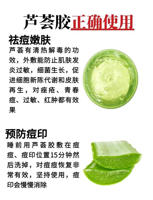 芦荟胶有什么功效