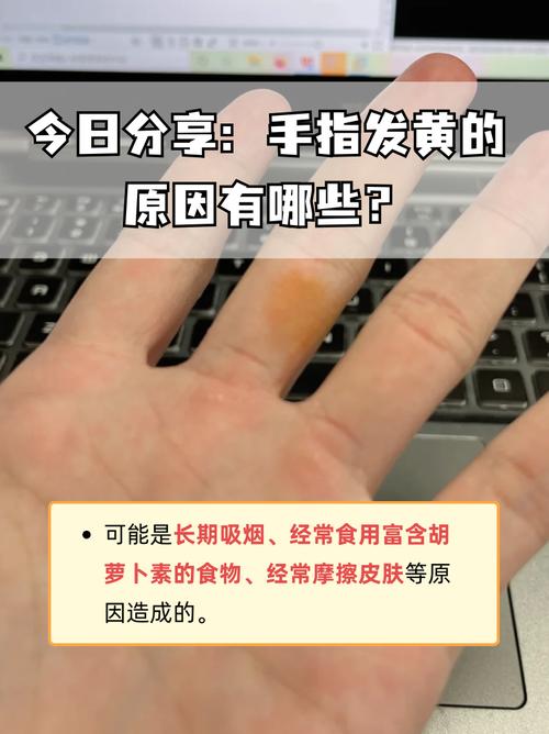 为什么手指发黄