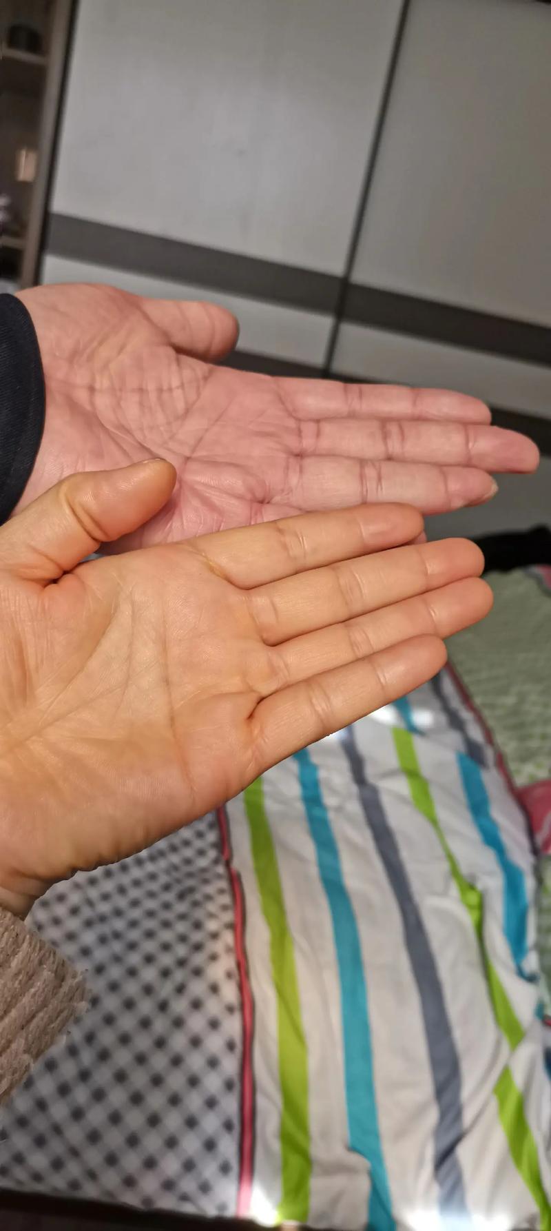 为什么手指发黄