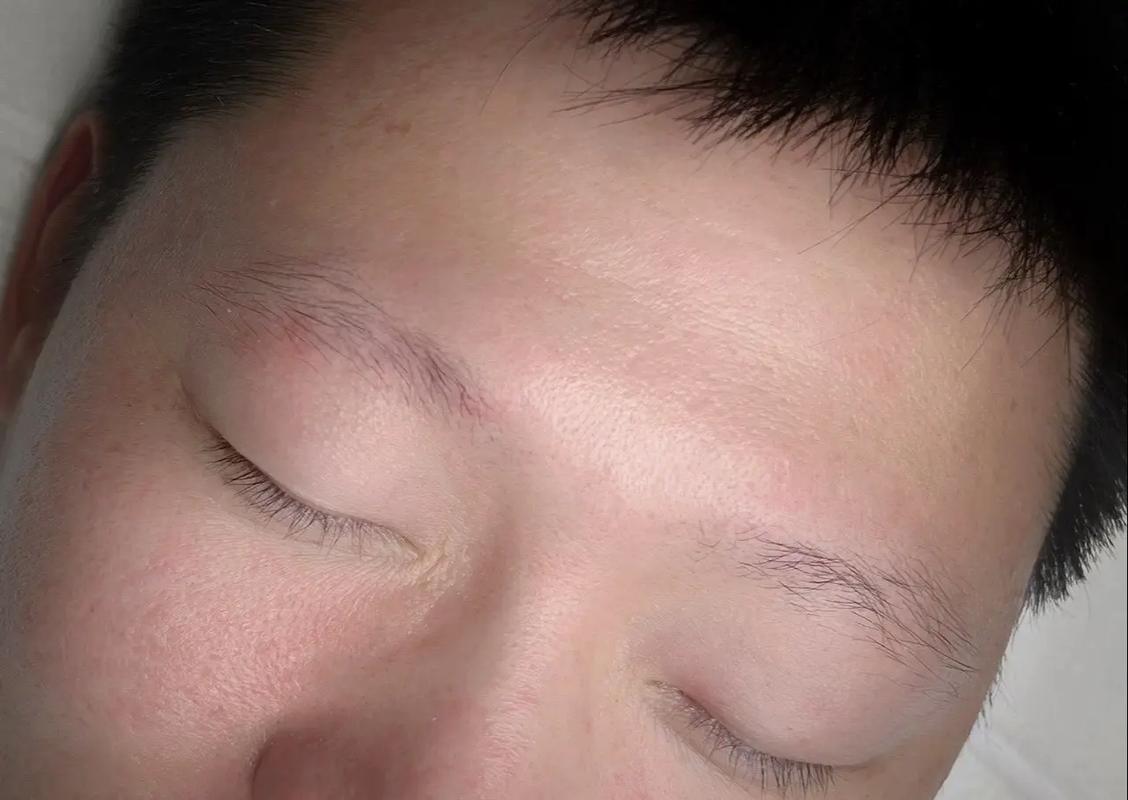 为什么眉毛少
