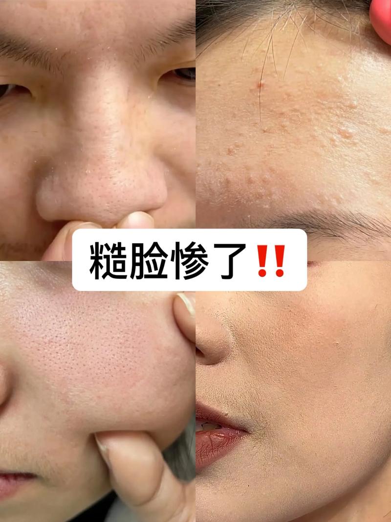 毛孔粗大用的洗面奶