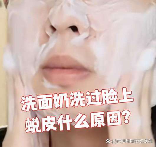 洗面奶用后起皮干燥