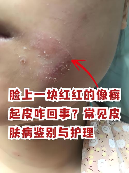 脸过敏是什么原因