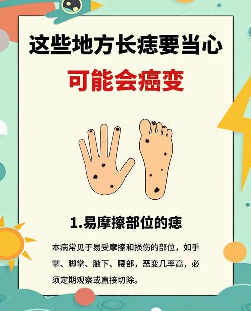 痣为什么会痛