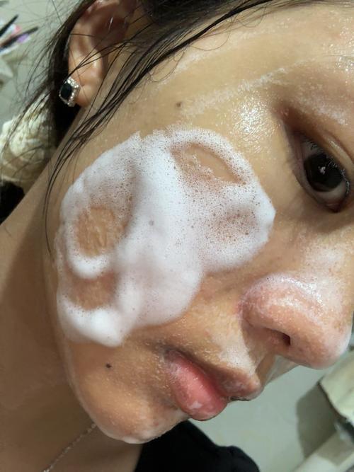 雅漾洗面奶用完脱皮