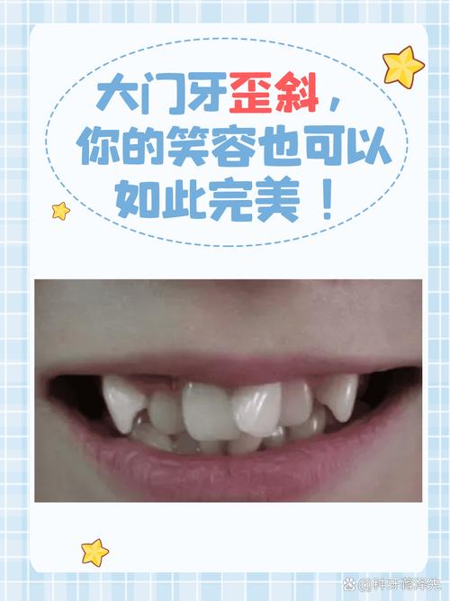 牙齿为什么会歪