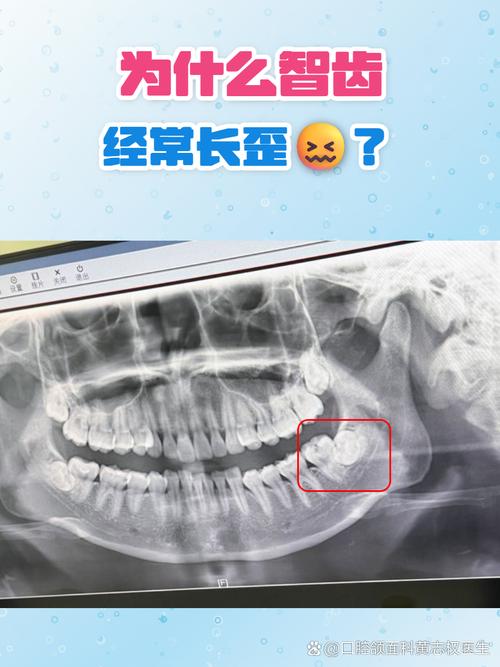 牙齿为什么会歪