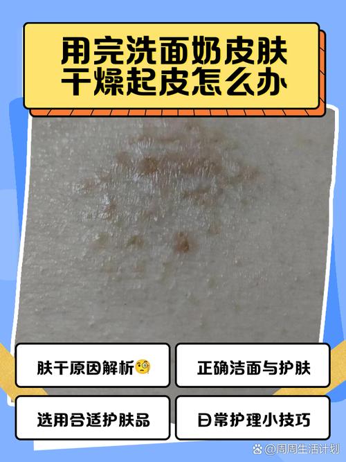 洗完洗面奶脸会干吗