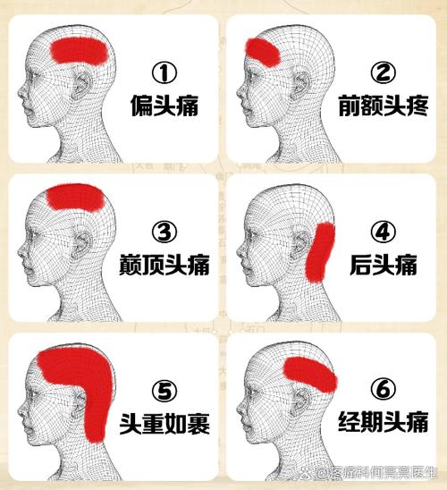 为什么额头会痛