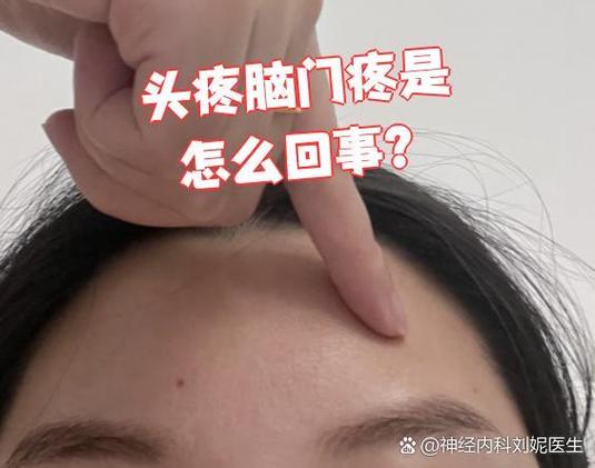 为什么额头会痛