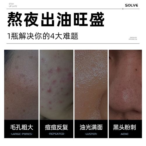 去黑头洗面奶洗多久