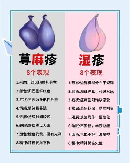 荨麻疹什么意思