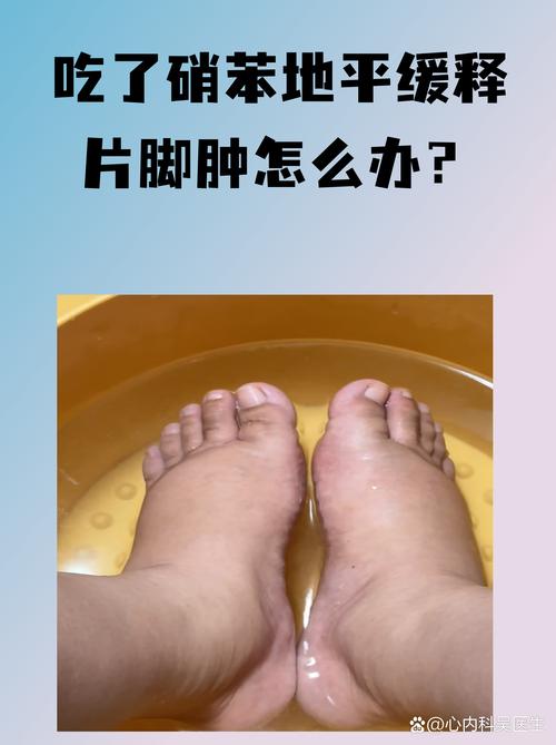 小腿水肿什么原因