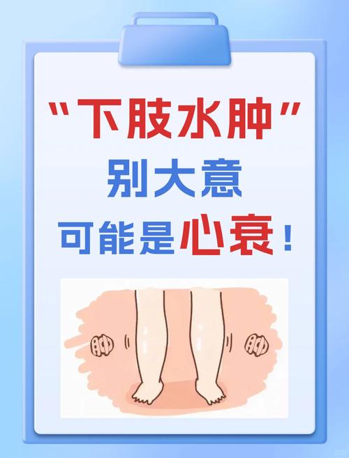 小腿水肿什么原因