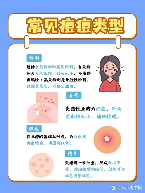 长痘痘是因为什么