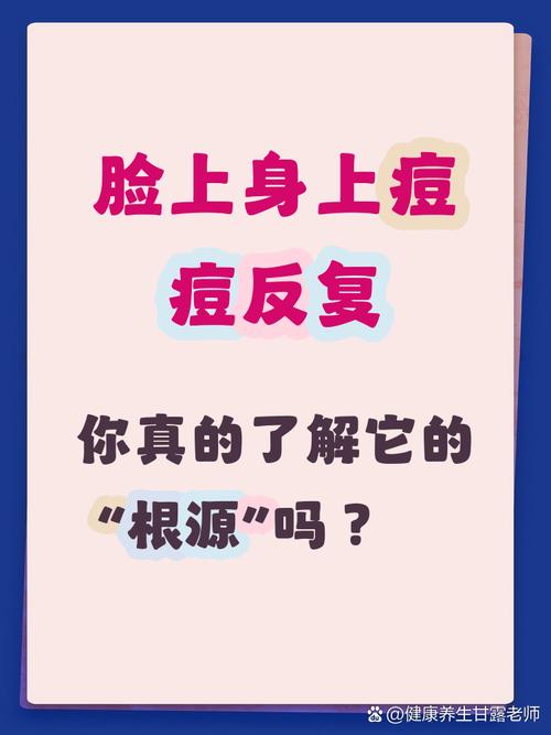 长痘痘是因为什么