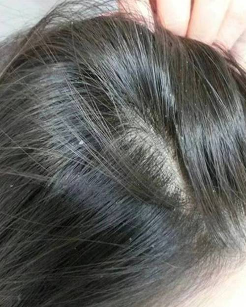 头皮是什么颜色