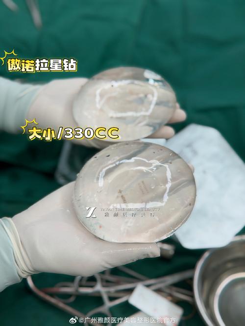 假体是什么材料