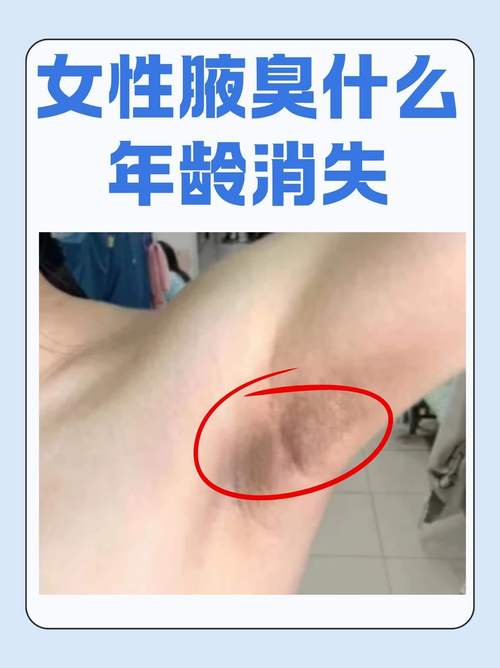 为什么有腋臭