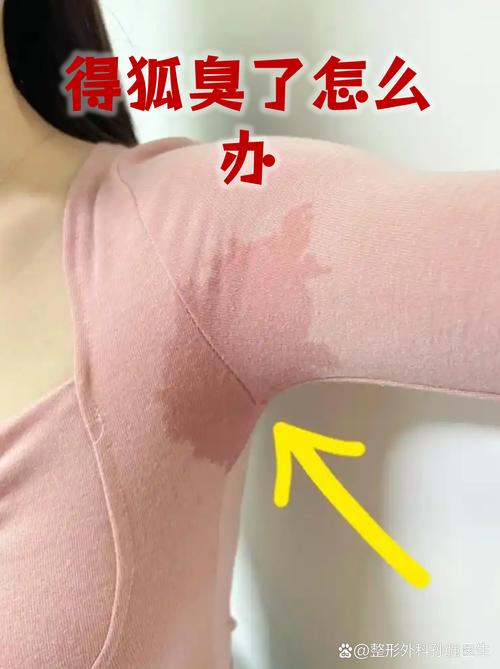 为什么有腋臭